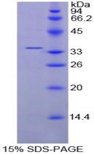 Figure. SDS-PAGE