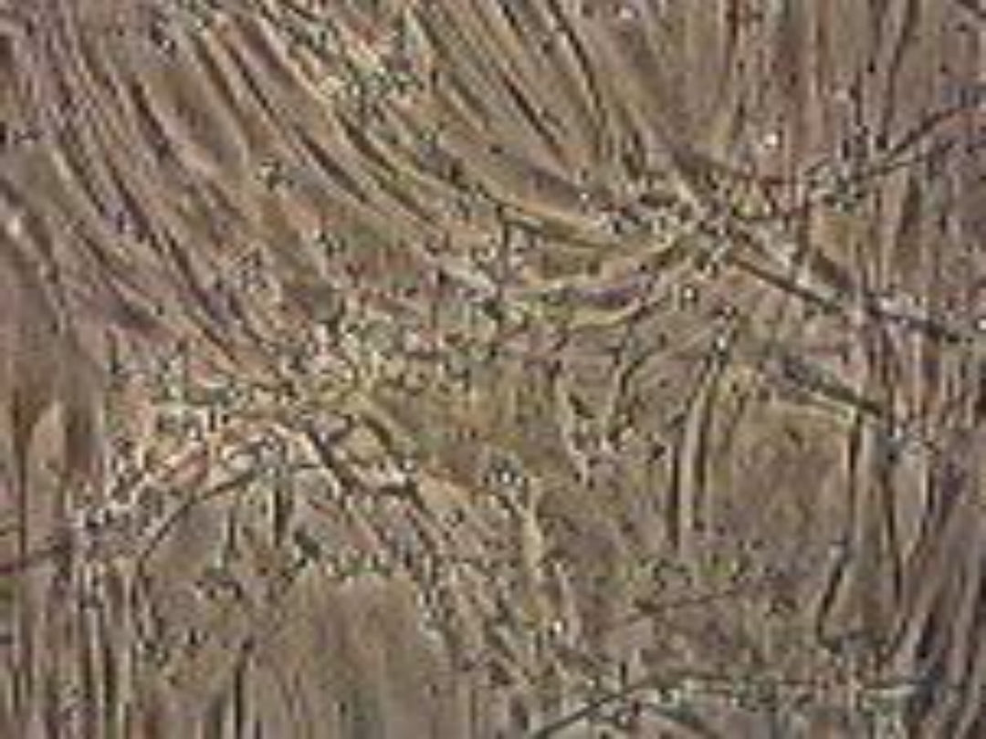 Primary Human Coronary Artery Smooth Muscle Cells