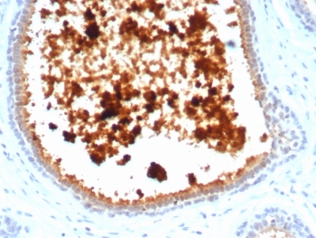 IHC staining of FFPE human lactating breast tissue with recombinant MGB1 antibody (clone MGB/4811R). HIER: boil tissue sections in pH 9 10mM Tris with 1mM EDTA for 20 min and allow to cool before testing.