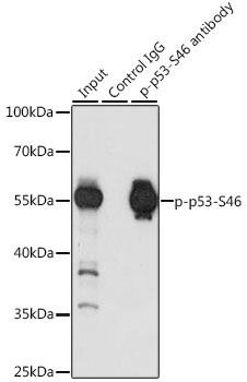 Anti-p53 (phospho S46) Antibody