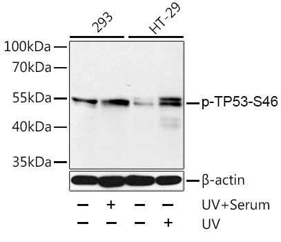 Anti-p53 (phospho S46) Antibody