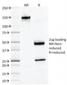 SDS-PAGE Analysis of Purified, BSA-Free Desmin Antibody (clone DES/1711). Confirmation of Integrity and Purity of the Antibody.