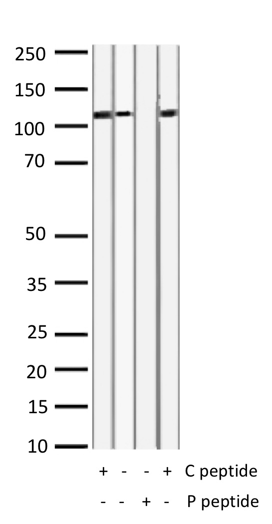 Western Blot of 10ug liver lysates from mouse (lanes 1 and 2) and rat (lanes 3 and 4) stained with EGFR-pS671 Rabbit Polyclonal Antibody AE00301 at 1ug/ml (overnight at 4℃) in the presence (+) or absence (-) of its antigen (P peptide) or its non-phosphorylated control (C peptide). ECL staining by HRP.
