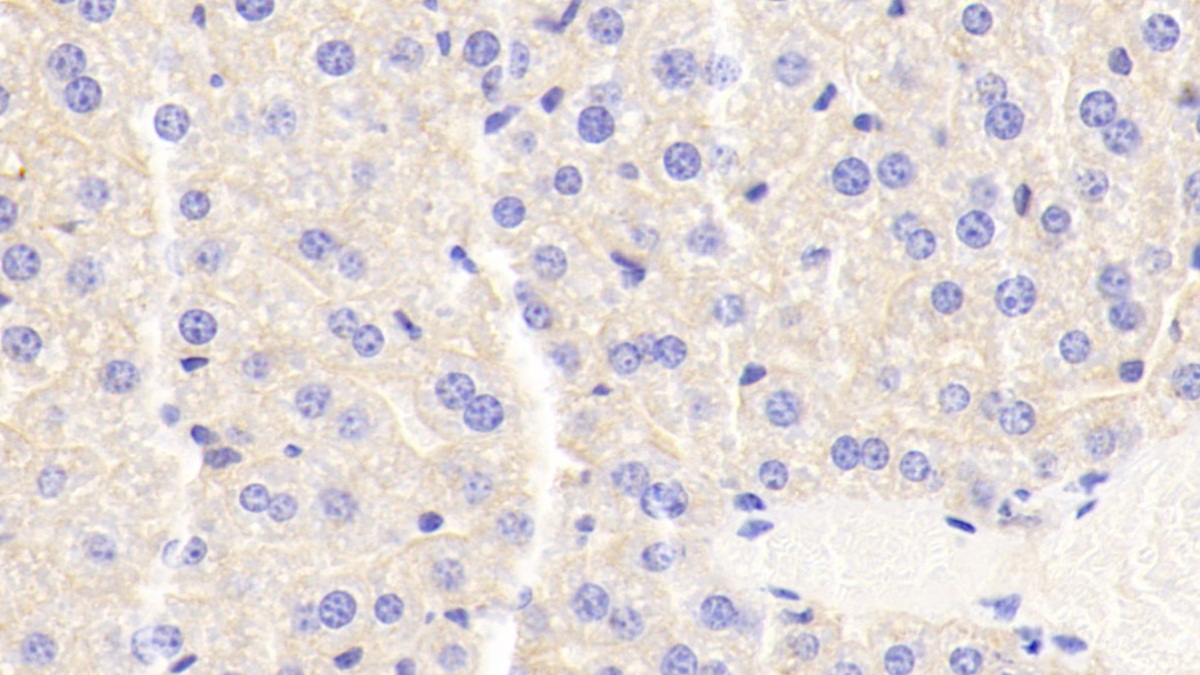 DAB staining on IHC-P; Samples: Mouse Liver Tissue;  Primary Ab: 20μg/ml Mouse Anti-Mouse APOC3 Antibody Second Ab: 2µg/mL HRP-Linked Caprine Anti-Mouse IgG Polyclonal Antibody (Catalog: SAA544Mu19)