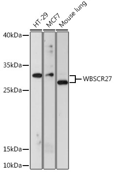 Anti-WBSCR27 Antibody