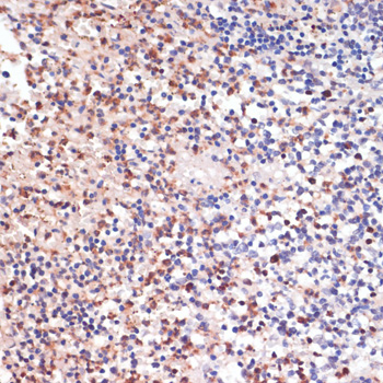 Anti-LYZ Antibody [Assigned #A10972]