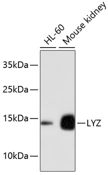 Anti-LYZ Antibody [Assigned #A10972]
