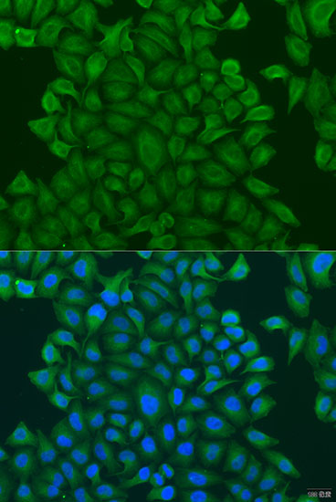 Anti-GSTM3 Antibody