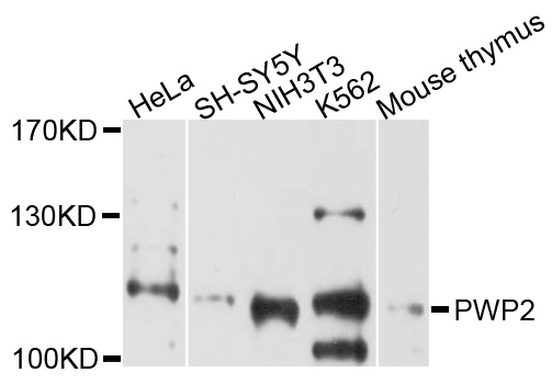 Anti-PWP2 Antibody