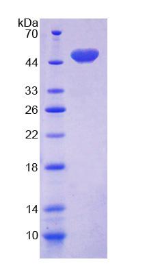 Figure. SDS-PAGE