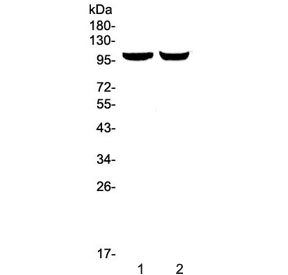 Western blot testing of 1) rat brain and 2) mouse brain lysate with Dynamin 2 antibody at 0.5ug/ml. Predicted molecular weight ~98 kDa.