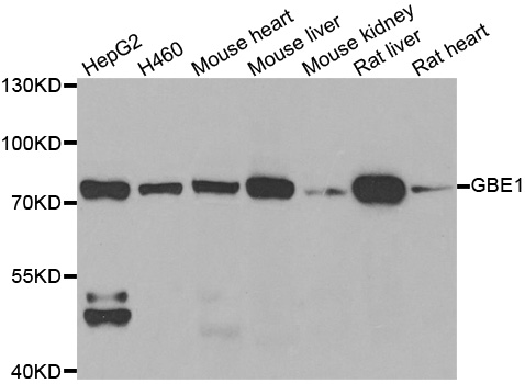 Anti-GBE1 Antibody