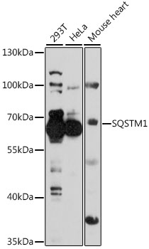 Anti-SQSTM1 Antibody