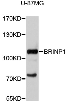 Anti-BRINP1 Antibody