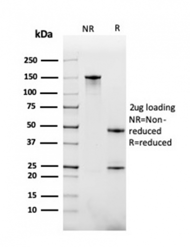 Anti-BAFF-R Antibody [BAFFR/1558]