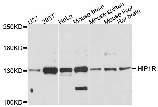 Anti-HIP1R Antibody