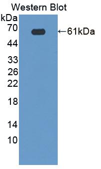 Western Blot; Sample: Recombinant protein.