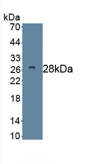 Western Blot; Sample: Recombinant DKK2, Human.