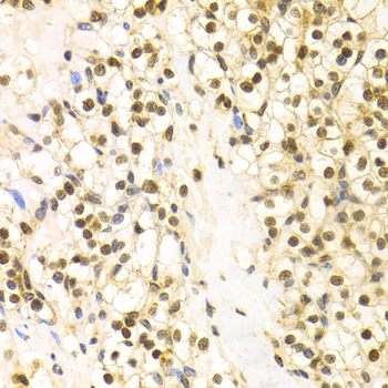 Anti-BAG1 Antibody