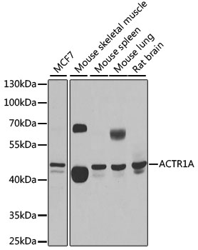 Anti-ACTR1A Antibody