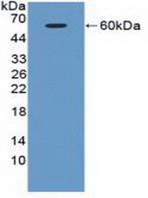 Western Blot; Sample: Recombinant ATM, Human.