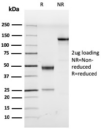 Anti-HHV8 LNA-1 Antibody [LN53]