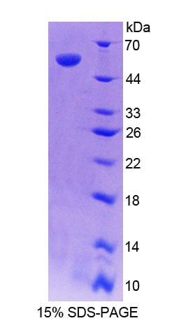 Figure. SDS-PAGE