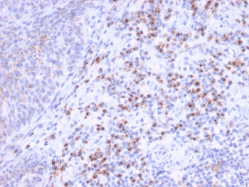 IHC staining of FFPE human tonsil tissue with EBAG9 antibody. HIER: boil tissue sections in pH 9 10mM Tris with 1mM EDTA for 20 min and allow to cool before testing.