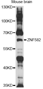 Anti-ZNF582 Antibody