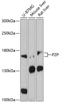 Anti-PZP Antibody