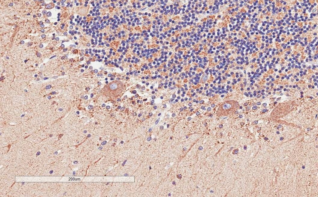 Anti-D Amino Acid Oxidase Antibody