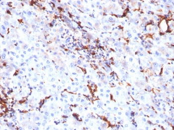 IHC testing of FFPE human liver tissue with Cathepsin K antibody (clone CTSK/2791). HIER: boil tissue sections in pH6, 10mM citrate buffer, for 10-20 min followed by cooling at RT for 20 min.
