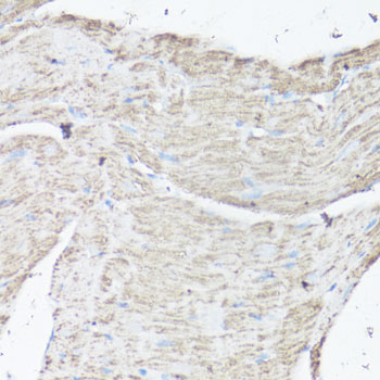 Anti-VDAC1 Antibody