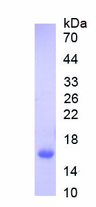 Figure. SDS-PAGE