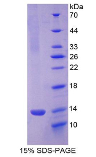 Figure. SDS-PAGE