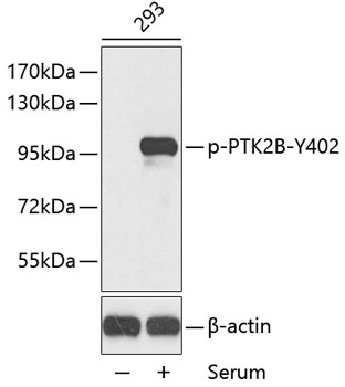 Anti-PTK2B (phospho Y402) Antibody