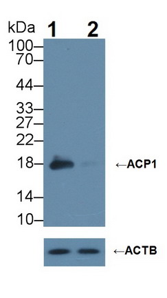 Knockout Varification: &lt;br/&gt;Lane 1: Wild-type Hela cell lysate; &lt;br/&gt;Lane 2: ACP1 knockout Hela cell lysate; &lt;br/&gt;Predicted MW: 18kDa      &lt;br/&gt;Observed MW: 17kDa&lt;br/&gt;Primary Ab: 1µg/ml Rabbit Anti-Rat ACP1 Antibody&lt;br/&gt;Second Ab: 0.2µg/mL HRP-Linked Caprine Anti-Rabbit IgG Polyclonal Antibody&lt;br/&gt;(Catalog: SAA544Rb19)