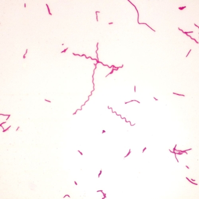 Rhodospirillum rubrum (Typical spirillum), w.m. Microscope Slide