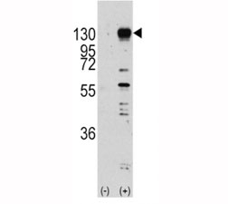 Western blot analysis of FGF receptor antibody and 293 cell lysate (2 ug/lane) either nontransfected (Lane 1) or transiently transfected with the FGFR1 gene (2). Predicted molecular weight: 75-160 kDa depending on glycosylation level.