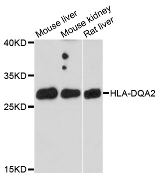Anti-HLA-DQA2 Antibody