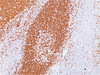 IHC testing of human tonsil with PAX5 antibody. Required HIER: boil tissue sections in pH 9 10mM Tris with 1mM EDTA for 10-20 min followed by cooling at RT for 20 min.
