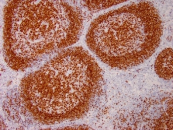 IHC testing of human tonsil with PAX5 antibody. Required HIER: boil tissue sections in pH 9 10mM Tris with 1mM EDTA for 10-20 min followed by cooling at RT for 20 min.