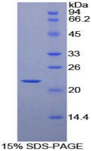 Figure. SDS-PAGE