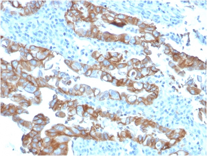 Anti-TROP2 Antibody [TACSTD2/2153]