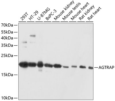 Anti-AGTRAP Antibody