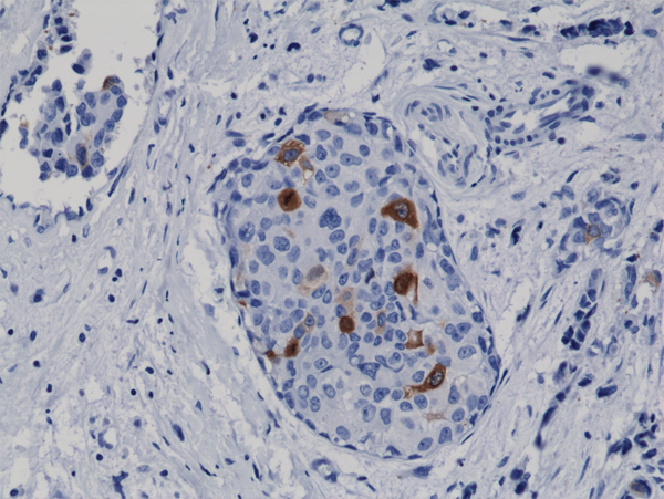 Anti-Cyclin B1 Antibody [RM281]