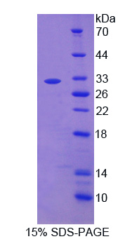 Figure. SDS-PAGE