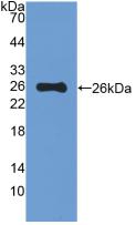 Western Blot; Sample: Recombinant MUC5B, Mouse.