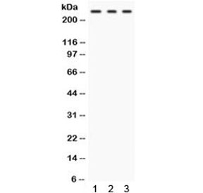 Western blot testing of human 1) HepG2, 2) U87 and 3) Raji cell lysate with FASN antibody. Expected molecular weight ~270 kDa.