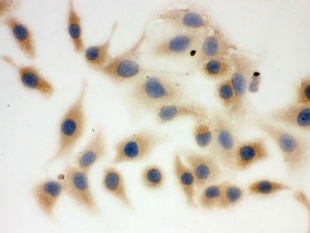 ICC testing of FFPE human A549 cells with FASN antibody. HIER: Boil the paraffin sections in pH 6, 10mM citrate buffer for 20 minutes and allow to cool prior to staining.